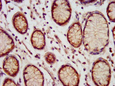 MEIS3 Antibody