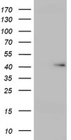 MEK1 (MAP2K1) antibody