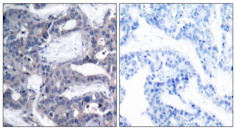 MEK-2 (Phospho-Thr394) Antibody