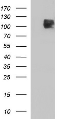 MEK3 (MAP2K3) antibody