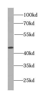 MEK4 antibody
