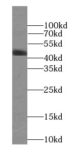 MEK4 antibody