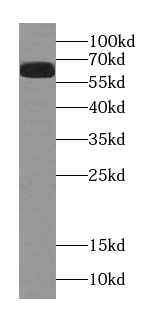 MEKK2 antibody