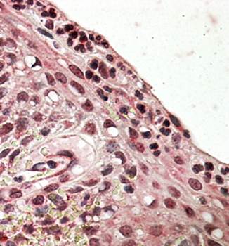 Goat anti-PRDM1 / MEL1 Antibody