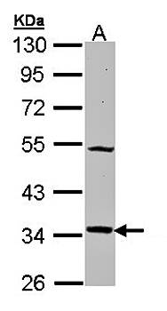 MELA-R antibody