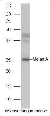 Melan A antibody