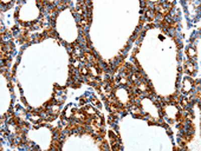 MTNR1A Antibody
