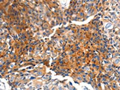 MTNR1A Antibody