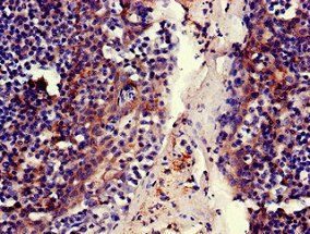 MELTF Antibody