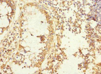 MEMO1 Antibody