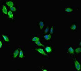 MEN1 antibody