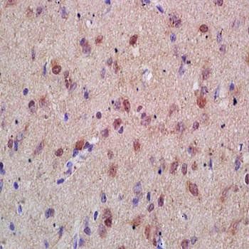 Menin Rabbit Polyclonal Antibody