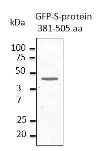 Anti-MERSC-CoV Spike Protein