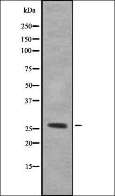MESDC2 antibody