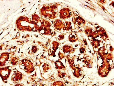 Mesothelin antibody