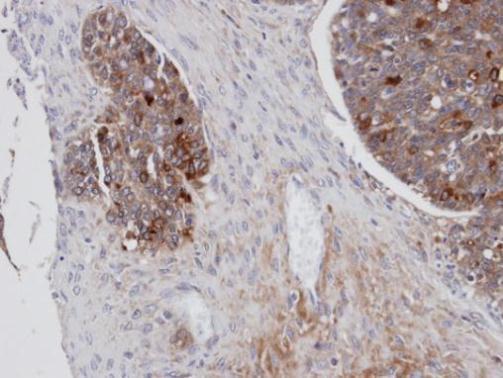 Mesothelin antibody [N1C2]