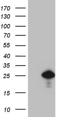 Mesothelin (MSLN) antibody