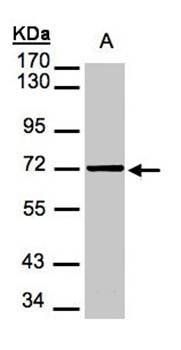 Mesothelin antibody