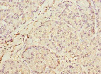 MEST Antibody