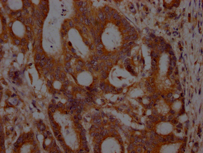 MET Recombinant Monoclonal Antibody