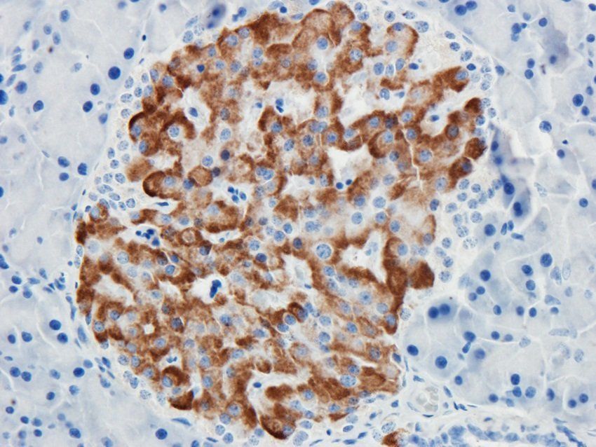 MET Rabbit Polyclonal Antibody