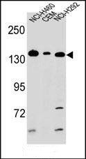 Metabotropic Glutamate Receptor 1 antibody