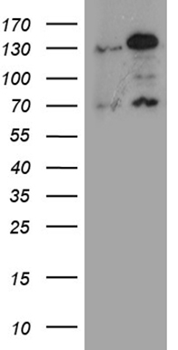 Metabotropic Glutamate Receptor 4 (GRM4) antibody