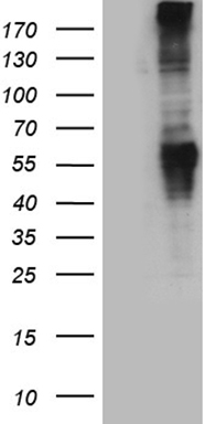 Metabotropic Glutamate Receptor 5 (GRM5) antibody