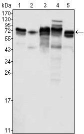 Metadherin Antibody