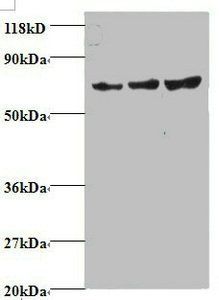 TIMP2 Antibody