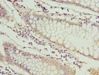 Metallothionein-1G antibody