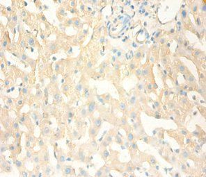MT1X Antibody