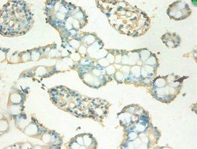MT2A Antibody