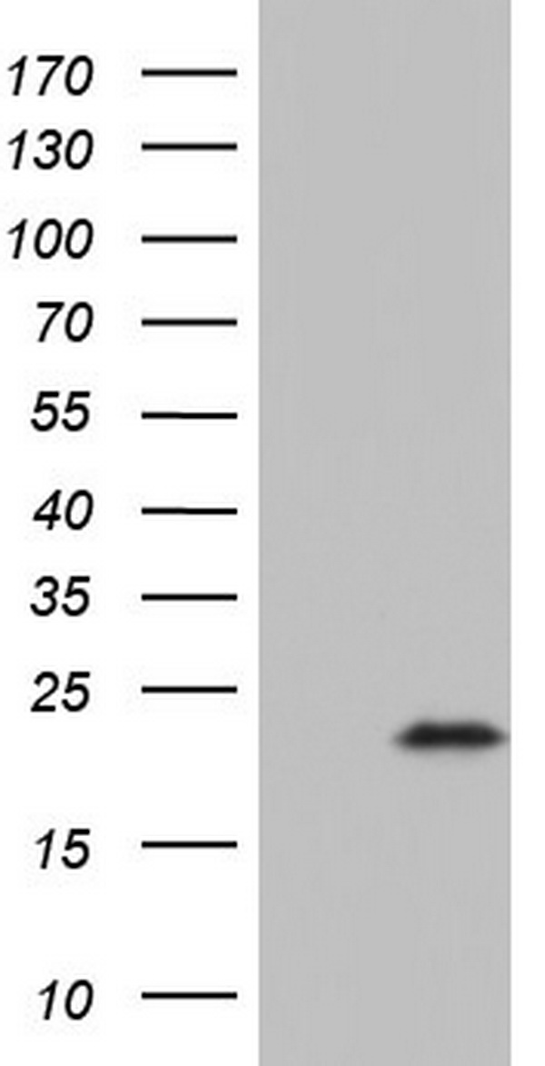 Methionine Aminopeptidase 2 (METAP2) antibody
