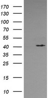 METT10D (METTL16) antibody