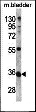 METTL11B antibody