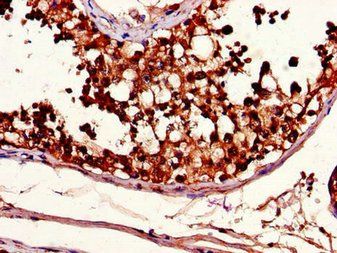 METTL14 antibody