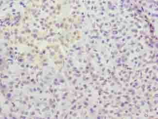 METTL25 antibody