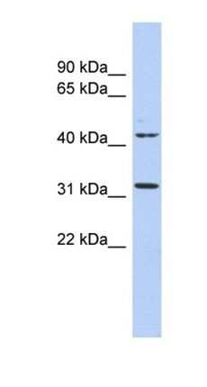 METTL6 antibody