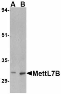 MettL7B Antibody