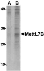 MettL7B Antibody