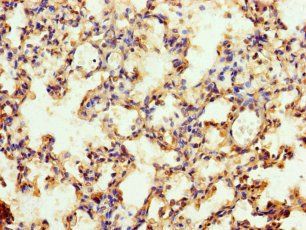 MFSD11 Antibody