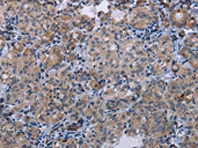 MFSD2A Antibody