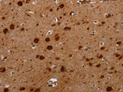 MFSD2A Antibody