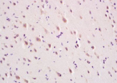 MFSD2A antibody