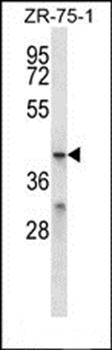 MFSD2B antibody