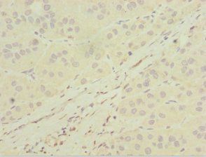 MGAT1 Antibody