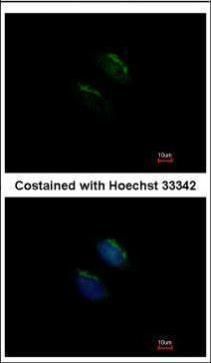MGAT3 antibody [N3C3]