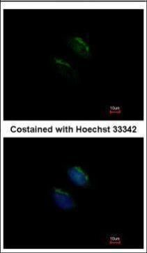 MGAT3 antibody