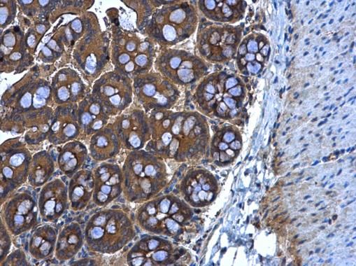 MGAT3 Rabbit Polyclonal Antibody